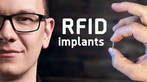 are rfid implants mandatory